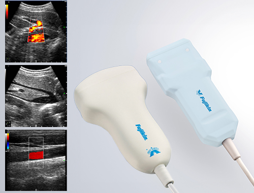 小型高画質超音波診断装置 MUS-P0303シリーズ｜医療ソリューション
